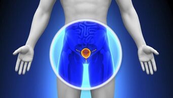 Tratamento da prostatite con drogas