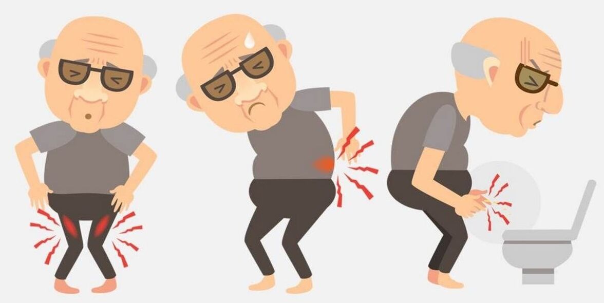 síntomas de prostatite